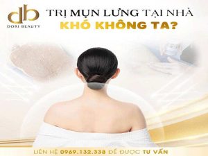 Cách Trị Mụn Lưng Tại Nhà Cực Đơn Giản
